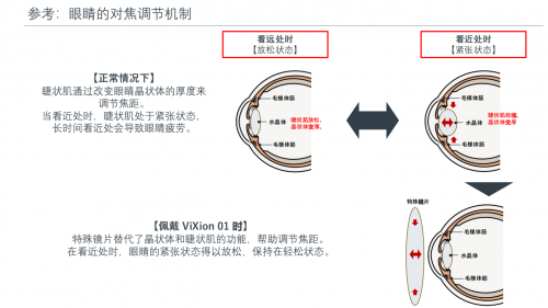 ViXion01自动对焦眼镜——科技助力，精准适配每一刻
