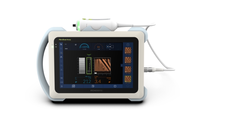 锤娜丽莎自曝重度脂肪肝？FibroScan®福波看用AI数据为肝脏健康“拉响警报”
