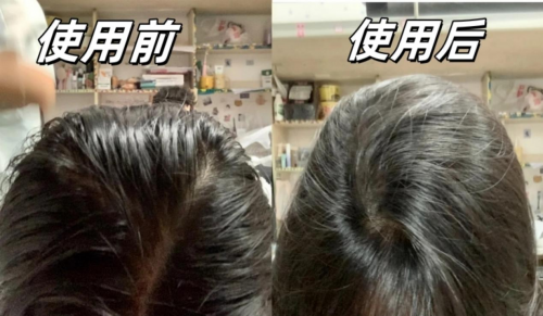 实测真管用！活丽度焕活控油去屑洗发水：靠科技赋能升级头皮 “清洁防护盾”！